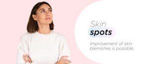 skin spots